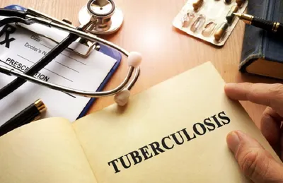 state govt  declares 78 villages tuberculosis free in nagaland