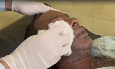 alarming rise in giant honey bee attacks in assam  10 treated in 8 days