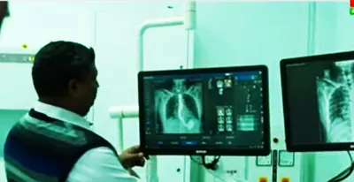 manipur  rims hospital gets advanced digital radiography fluoroscopy system