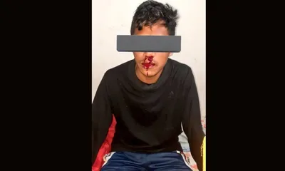 assam student assaulted in madhya pradesh university hostel  five students expelled