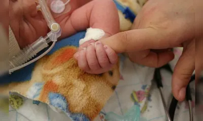 assam s maternal health horror  mother  amp  baby die in tinsukia 