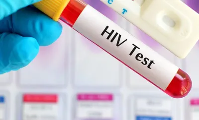 assam  hojai grapples with alarming surge in hiv cases