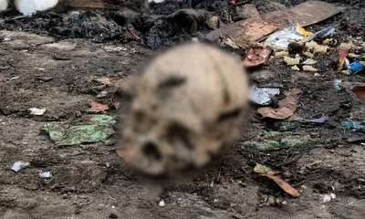 assam  human skull recovered from jorhat dumping ground