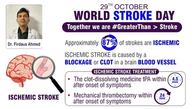 ischemic stroke treatment options  medications and intervention