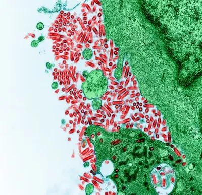 rabies is an ancient  unpredictable and potentially fatal disease