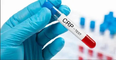 why is a crp test recommended 