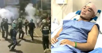 manipur  pellet guns used on protesting students in imphal  drawing mass condemnation