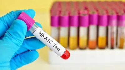 how many times should you get an hba1c test done 