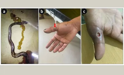 assam experts find dead cobras and kraits can still bite  a world first