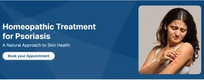 what is the best clinic for psoriasis treatment 