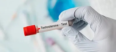 who should get a testosterone test done 